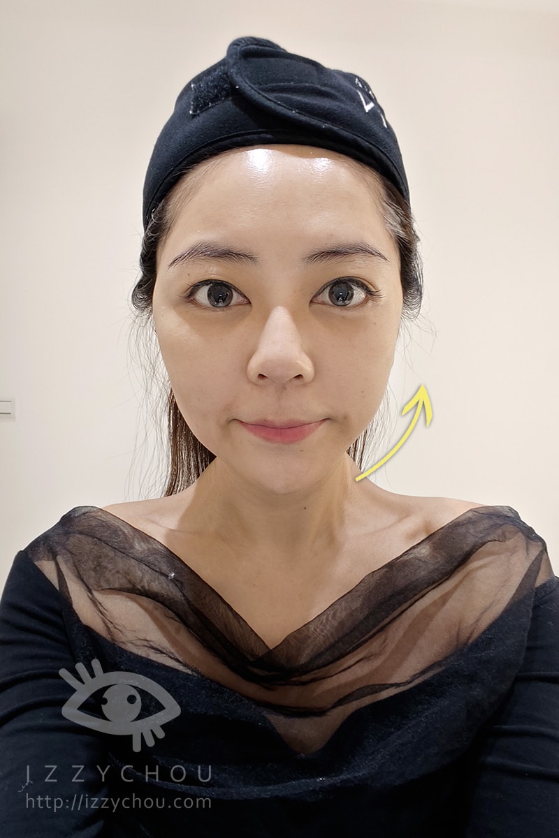 新竹沐煦診所評價真實心得｜熟齡肌打Z音波，毛芝岭醫師讓我找回緊緻發光感