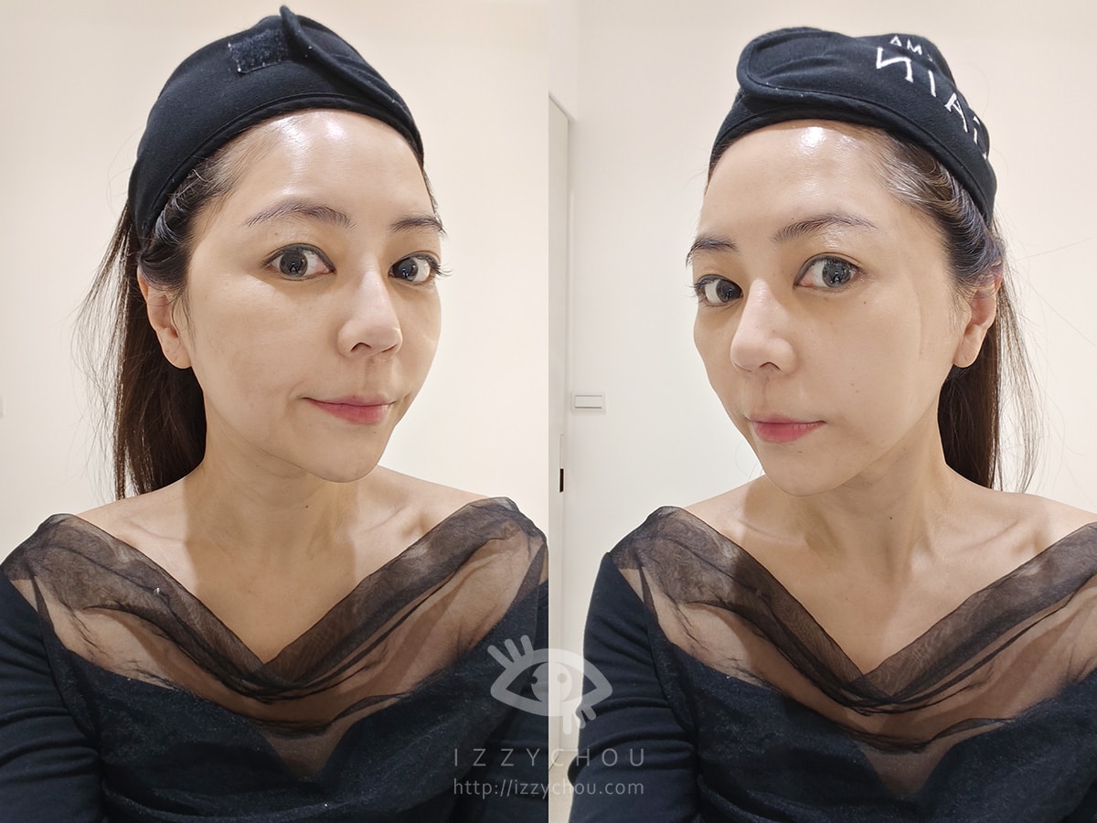 新竹沐煦診所評價真實心得｜熟齡肌打Z音波，毛芝岭醫師讓我找回緊緻發光感