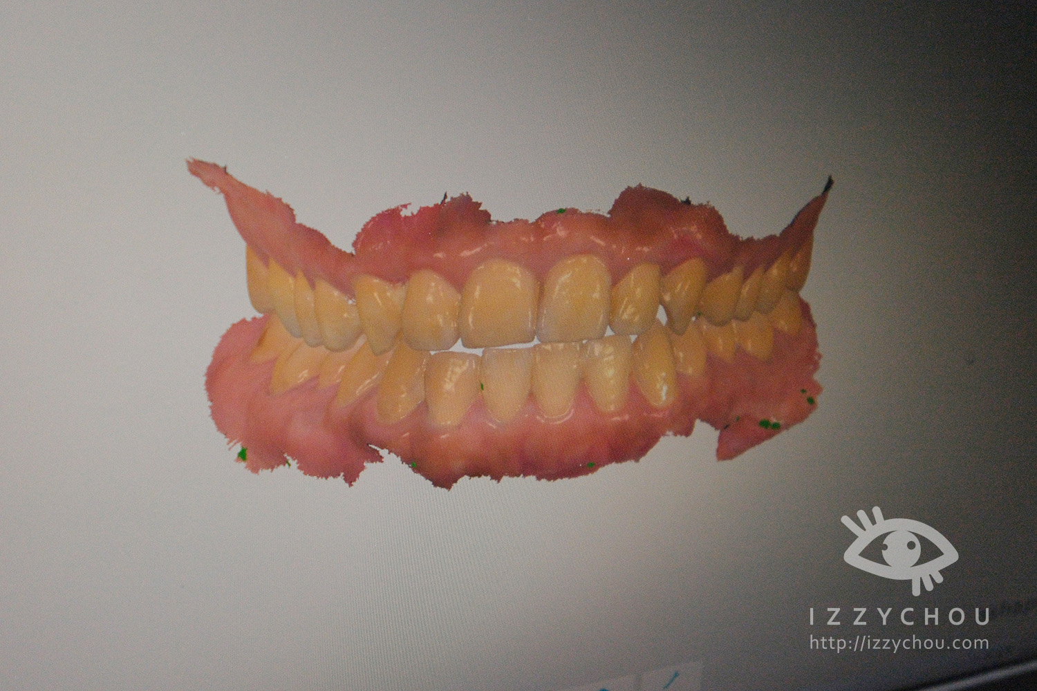 隱適美前必看!竹北牙齒矯正推薦心得:數位口掃建檔+矯正諮詢全紀錄【品悅牙醫診所|竹北牙醫推薦】 - 第17張圖 隱適美前必看!竹北牙齒矯正推薦心得:數位口掃建檔+矯正諮詢全紀錄【品悅牙醫診所|竹北牙醫推薦】